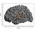 Estimer le temps avant contact : quelle zone du cerveau impliquée ?