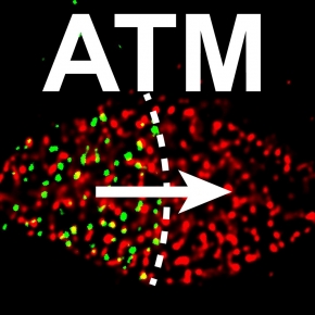 Réparation de l’ADN : ATM s’oppose aux liaisons dangereuses