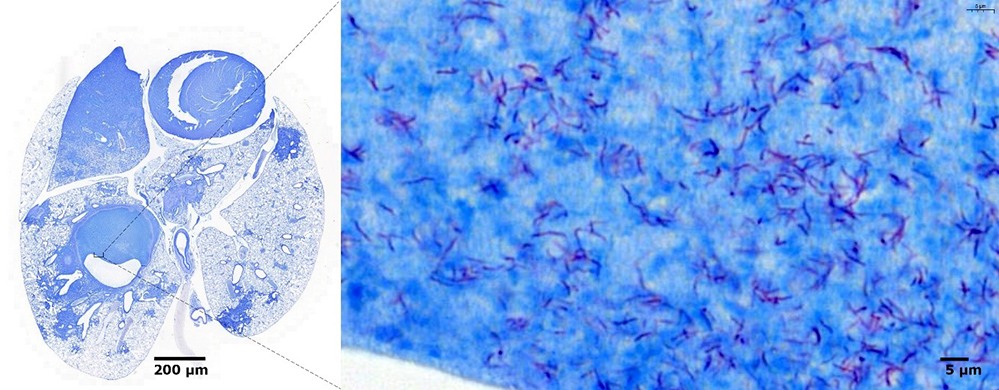 Identification d’adaptations clés pour la persistance des bacilles de la tuberculose chez l’hôte